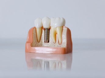 Dental Technician, specialist in crowns and bridges